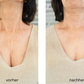 FRAUSCHMITZ Beauty Dekolleté vorher - nachher